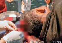 Diduga Cek Cok leseng lesengan di Warung Tuak , Seorang Pelajar Kritis di bacok diwarung tuak